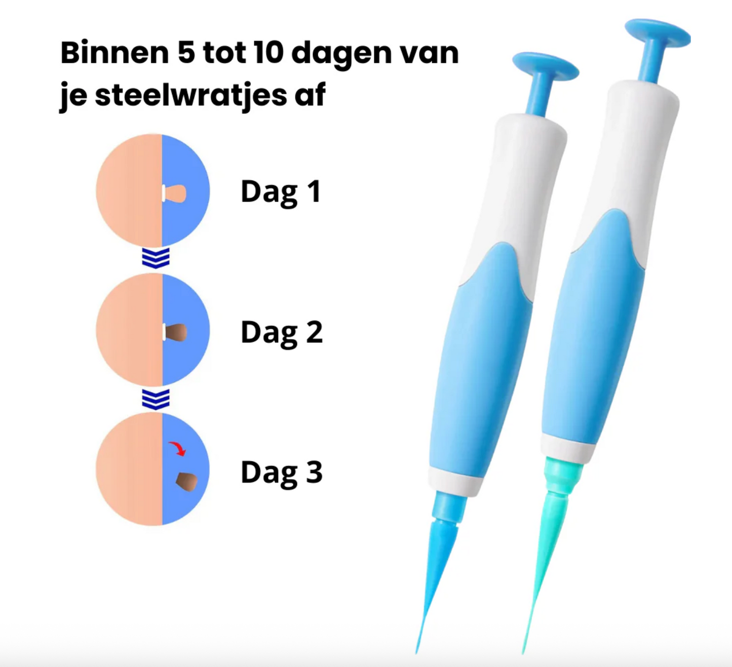 DermaPen Kit - Verwijder steelwratjes veilig en gemakkelijk thuis | 50% korting