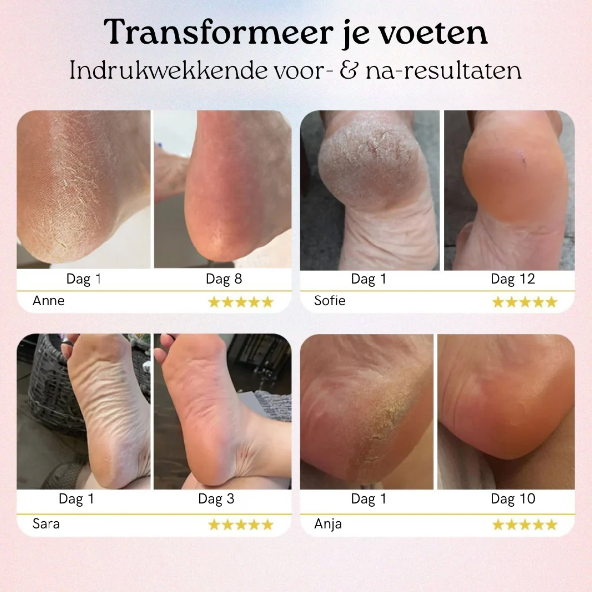 Veloria Pro - Voor babyzachte voeten zonder moeite | 50% korting